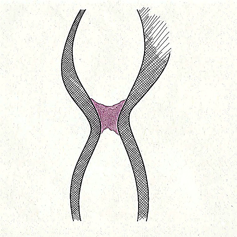 Ink and watercolor crossing forms